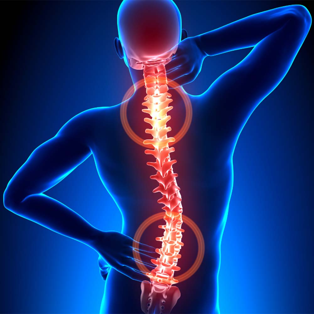 Ból kręgosłupa, przyczyny i leczenie